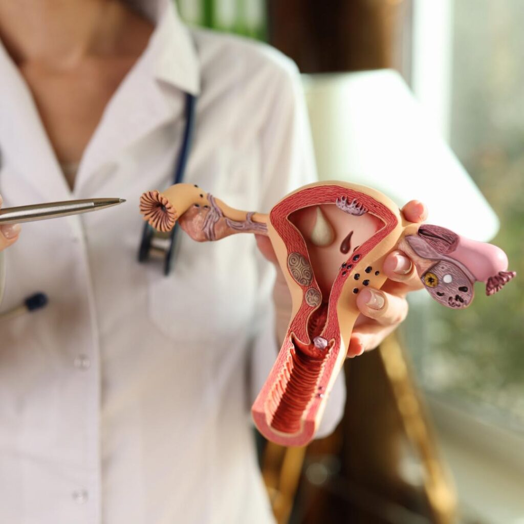 Videohisteroscopia: exame importante para avaliação da saúde uterina