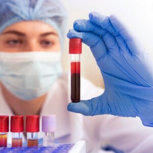 Entenda a importância dos exames laboratoriais para cuidar da sua saúde